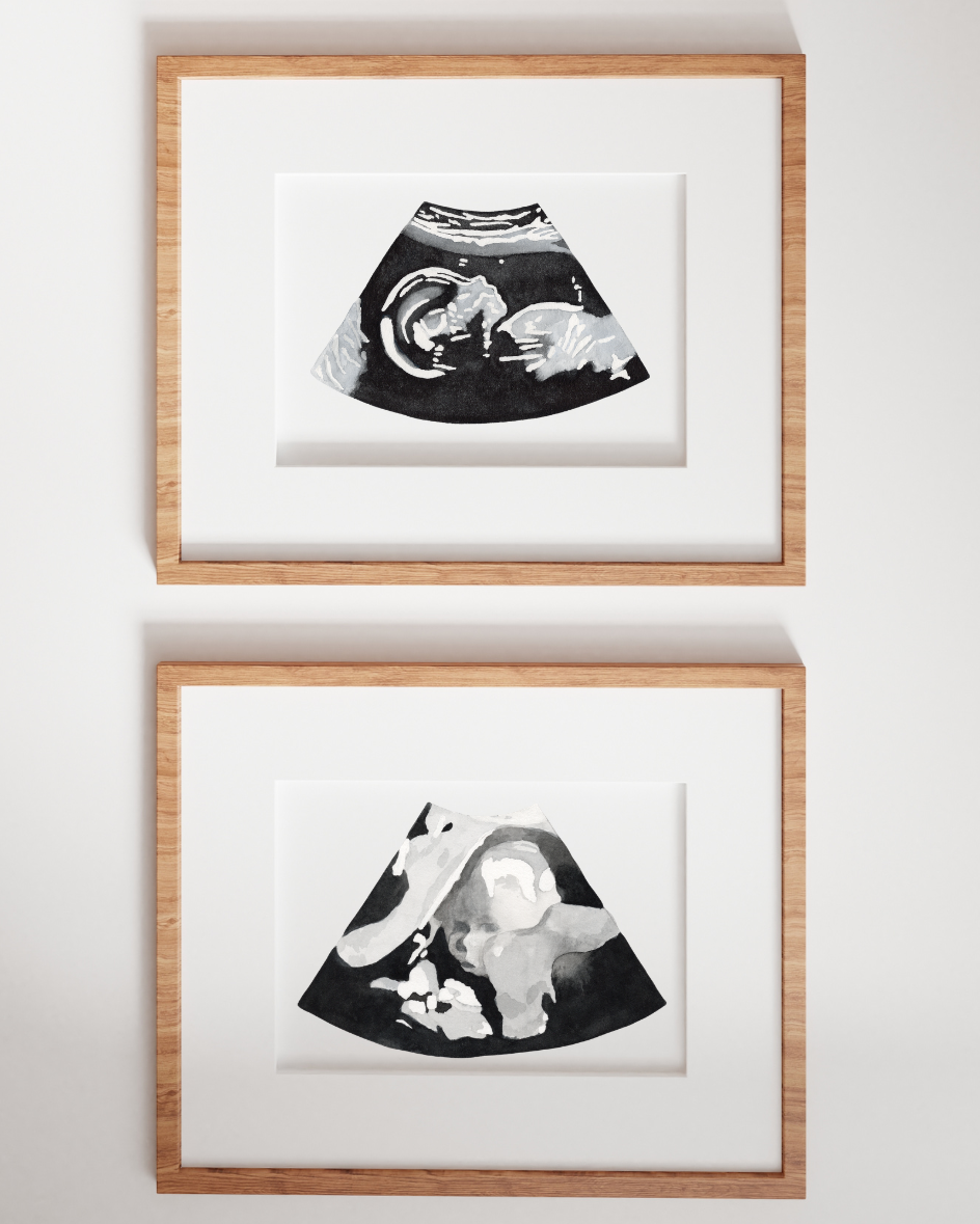 Heirloom Ultrasound