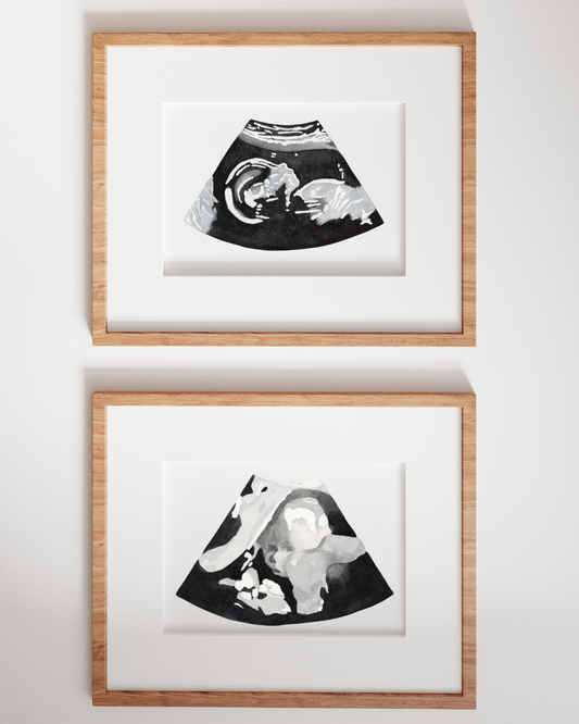 Heirloom Ultrasound